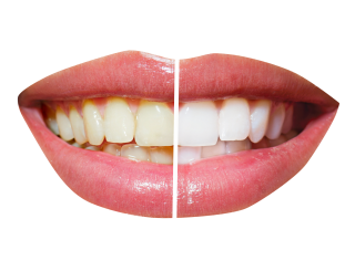 Teeth PNG File PNG images