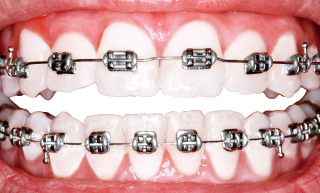 Teeth PNG Image PNG images