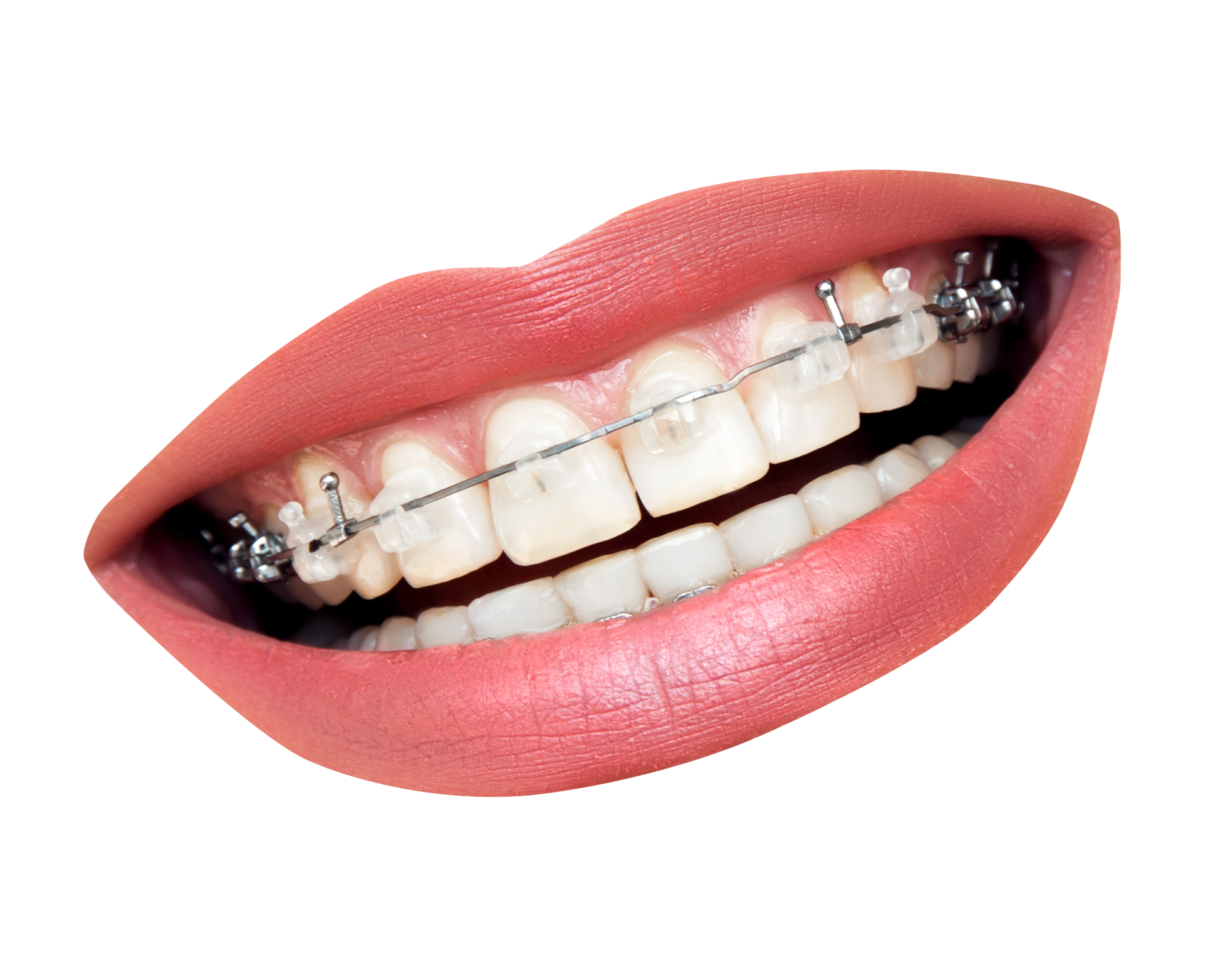 Teeth Png Teeth Transparent Background Freeiconspng - vrogue.co