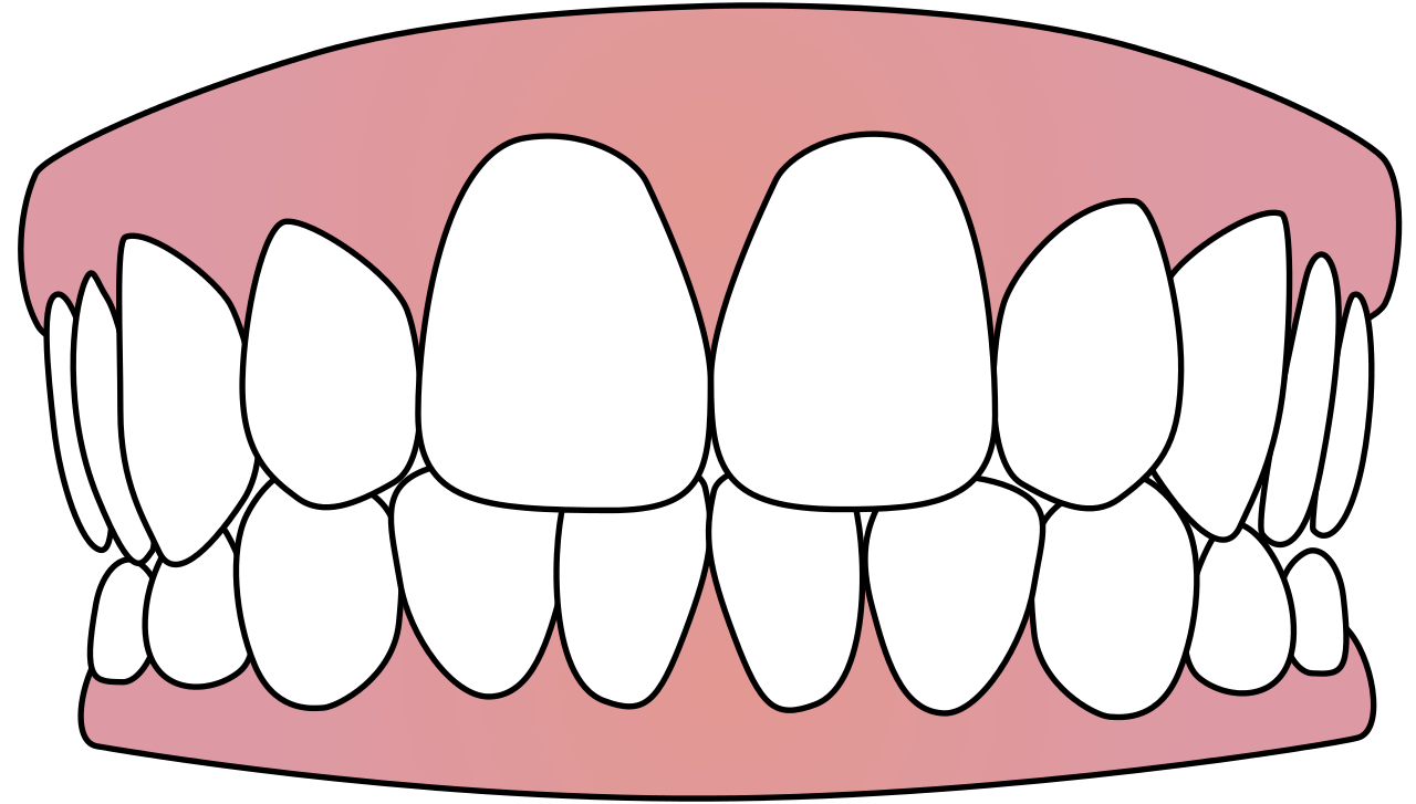 teeth illustration free download